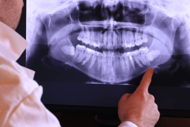 Emergency Gum Pain Relief in WA